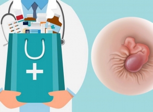 Có cách nào giúp co búi trĩ ngoại tại nhà không?